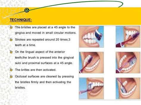 Brushing techniques