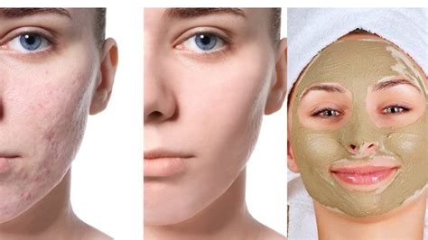 How To Use Multani Mitti On Face For Skin Whitening How To Use