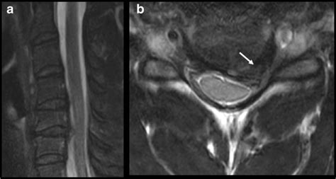 Clinical case. A 27-year-old male patient with acute onset of C6 ...