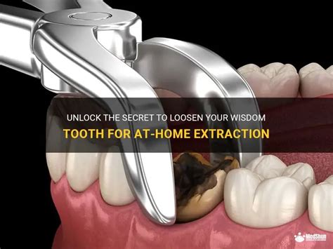 how to loosen a tooth at home