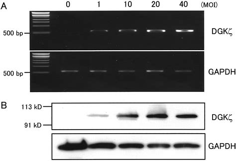 Adenovirus Mediated Overexpression Of Diacylglycerol Kinase Inhibits