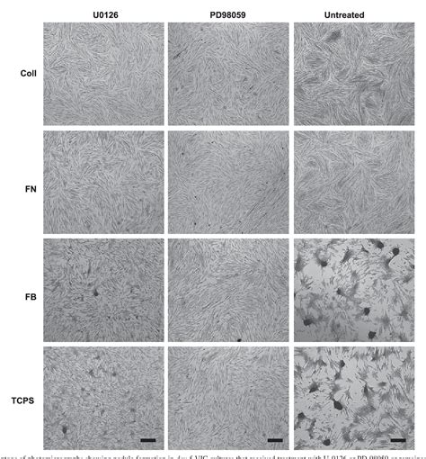 Figure From Role Of The Mapk Erk Pathway In Valvular Interstitial