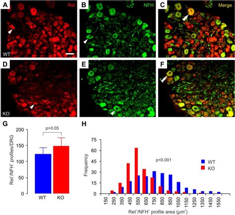 AF Ret And NFH Colocalize In A Population Of Thoracic DRG Neurons In