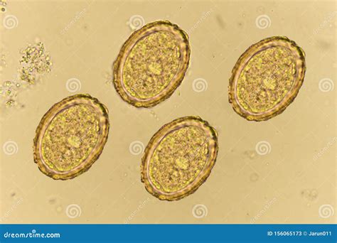 Ascaris Lumbricoides Microscope