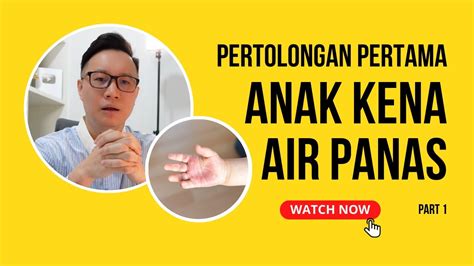 Pertolongan Pertama Anak Tersiram Air Panas Part 1 Youtube