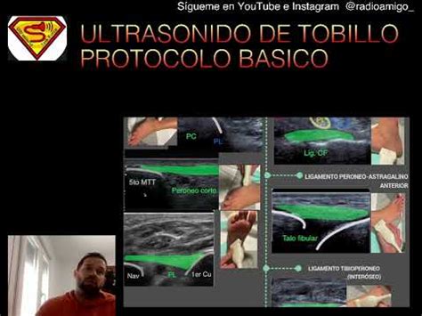 TOBILLO ULTRASONIDO PROTOCOLO BASICO INFOGRAFICO ECOGRAFIA YouTube