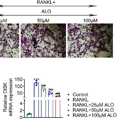 Aloperine Inhibits Rankl Induced Osteoclast Differentiation Of Raw