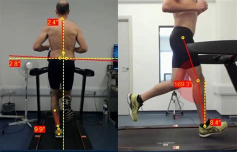 Portable Running Gait Analysis System For Clinical Gaiton At Best