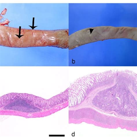 Strongyloides Associated Colonic Nodules Cat A Mucosal Surface Colon Download Scientific