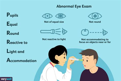 What Perrla Means In Your Eye Exam