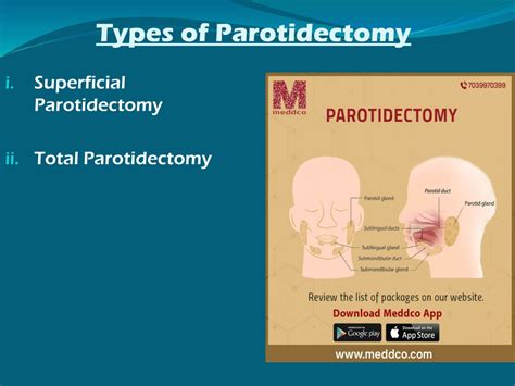 Ppt Parotidectomy Ppt Powerpoint Presentation Free Download Id