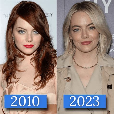 Emma Stone Plastic Surgery Before And After PlasticSurgeryInsights