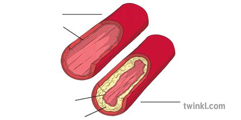 Cholesterol Diagram Unlabelled Artery Blood Vessel Heart Science Ks2