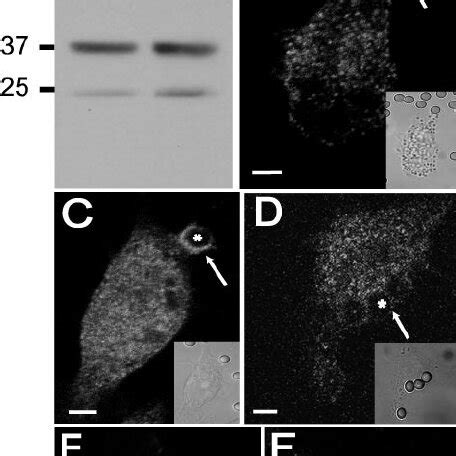 Dominant Negative Crkii Inhibits Fc Mediated Phagocytosis A Schematic