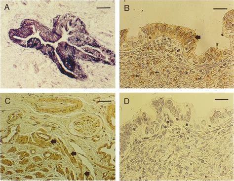 Nadph Diaphorase Staining And Immunohistochemistry Of The Human