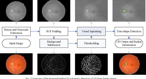 Figure 2 From Automatic Detection Of Retinal Optic Disc Using Vessel