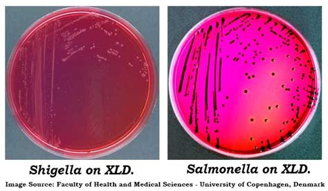 Xylose Lysine Deoxycholate (XLD) Agar- Principle, Uses, Composition ...