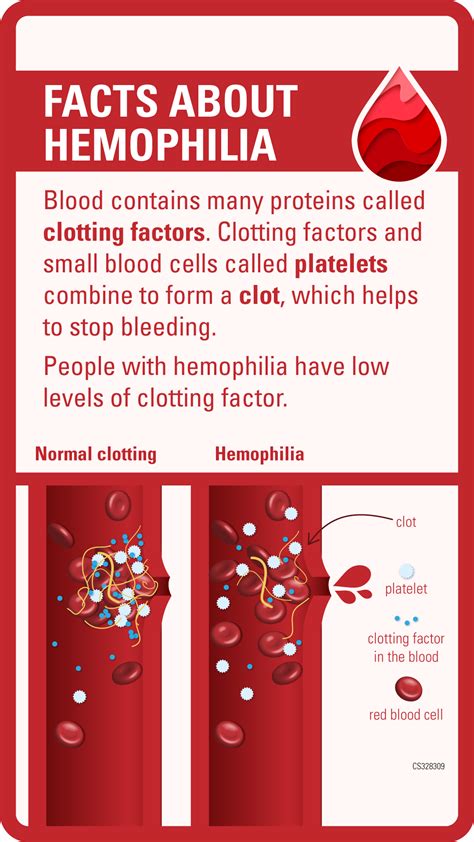 Hemophilia Buttons Hemophilia Cdc