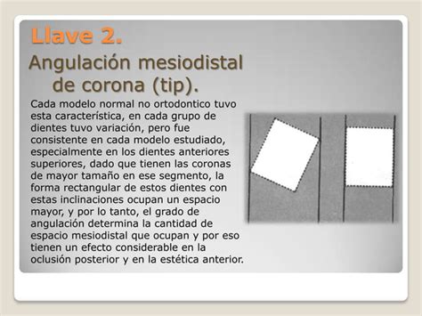 Articulo De Las Llaves De La Oclusion Pdf