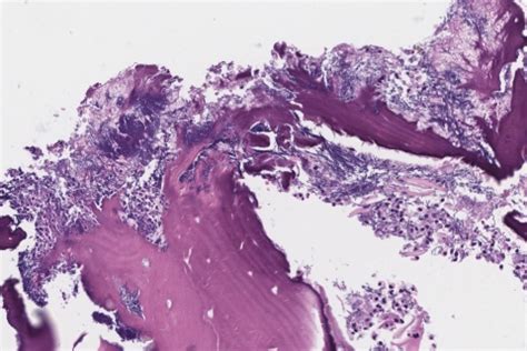 Bones Of The Jaw Ottawa Atlas Of Pathology