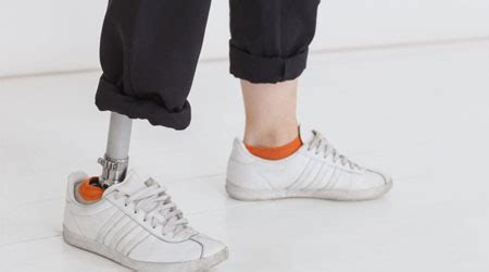 肢体不自由や義足など上肢・下肢の障害で障害年金を得る認定基準 | 障害者グループホームラボ