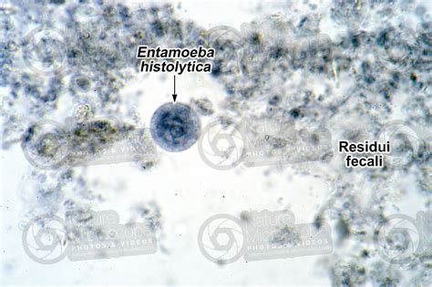 Entamoeba Histolytica Amebiasi 250x Protozoa Protozoi Endoparassiti Parassitologia Foto