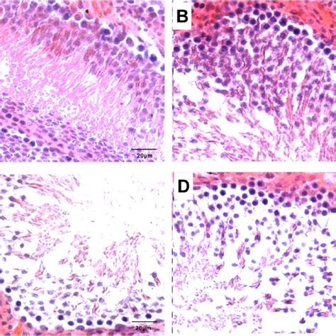 Histopathologic Analysis Of Testicular Tissues After 4 Weeks Of