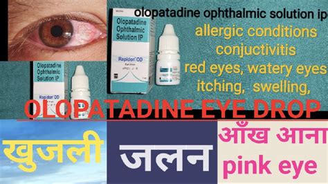 Olopatadine Eye Drops Olopatadine Ophthalmic Solution Ip Olopat Eye