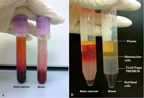 Factors Influencing The Successful Isolation And Expansion Of Aging