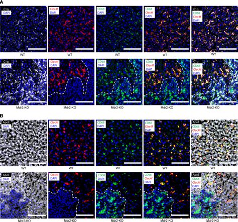 Frontiers The C1q Apoe Complex A New Hallmark Pathology Of Viral