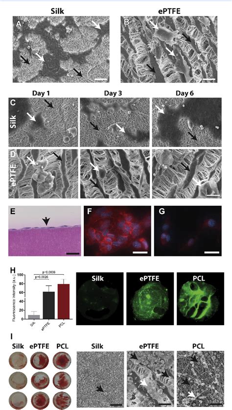 Figure 1 From Rapid Endothelialization Of Off The Shelf Small Diameter