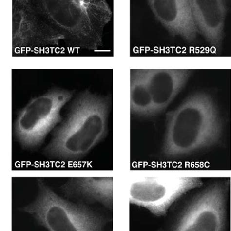 Intracellular Localization Of Sh3tc2 A Rat Schwann Cells Transiently