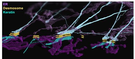 Pemphigus Vulgaris A Rare Skin Blistering Disease Lions Talk Science