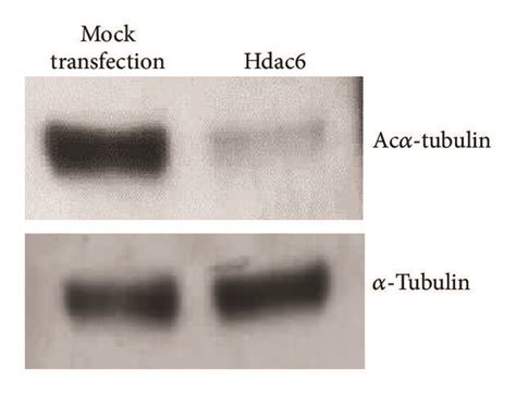 Hdac6 Protein Overexpression And Its Effect On Tubulin Acetylation In