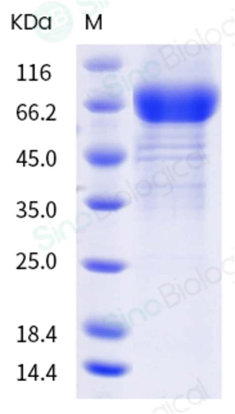 Sino Biological Human Il R Il R Protein Fc Tag Ug Quantity