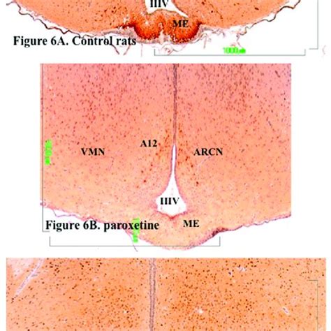 A C Tyrosine Hydroxylase Immunoreactivity In The Mediobasal Download Scientific Diagram