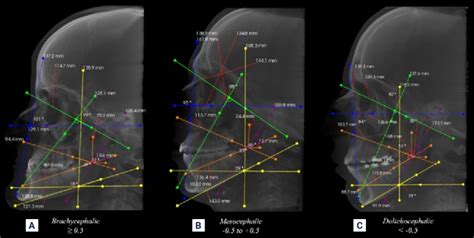 · Sagittal Reconstructions Of Cone Beam Computed Tomography Download Scientific Diagram