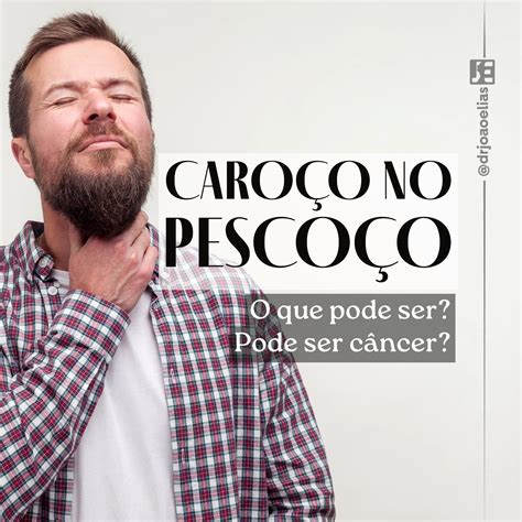 O Que Pode Ser Caroco No Pescoco - Caroço no Pescoço - O que pode ser? Pode ser câncer? | Dr João Elias
