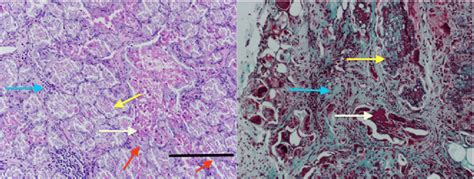 Photomicrographs Showing Decalcified Sections Stained With Hematoxylin