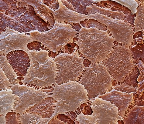 Keratinised Gingiva Sem Stock Image C0578537 Science Photo Library