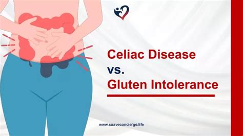 Ppt Celiac Disease Vs Gluten Intolerance Powerpoint Presentation Free Download Id13309623