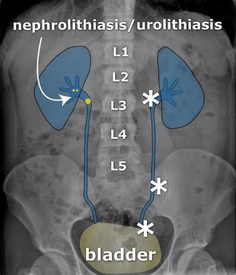 Pin By Ashley Zimmer On Instructor Lecture Radiology Imaging