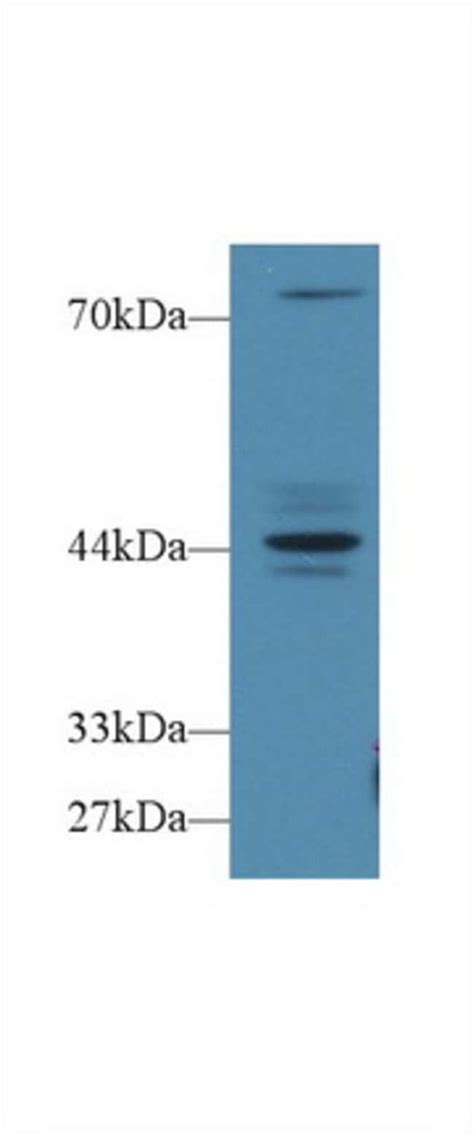 Fbrs Polyclonal Antibody Invitrogen™ 100 μl Unconjugated Fisher