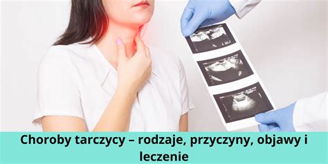 Choroby Tarczycy Rodzaje Przyczyny Objawy Leczenie