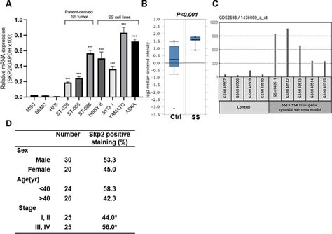 Skp2 Is Overexpressed In Ss Cell Lines Patient Samples And Transgenic