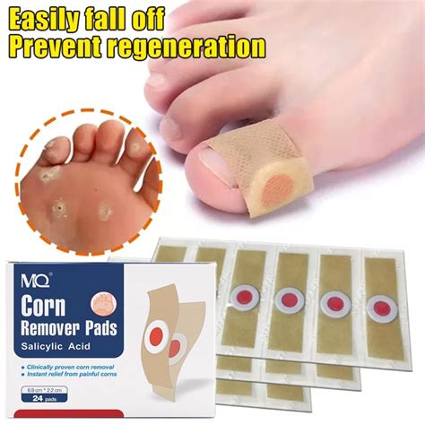 24Pcs Box Foot Corn Removal Plaster Warts Thorn Patch Feet Warts