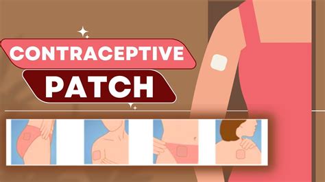 Contraceptive Patch How It Works