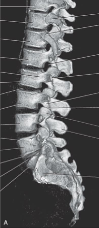 Thoracic Spine Diagram | Quizlet