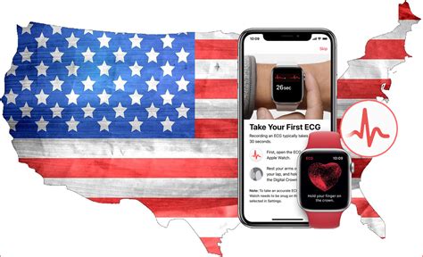 Por Qu La Aplicaci N De Ecg No Est Disponible En Apple Watch