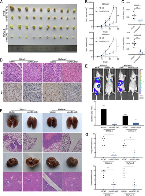 Circneil3 Facilitates The Tumorigenesis And Metastasis Of Pdac Cells In